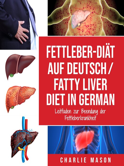 Title details for Fettleber-Diät Auf Deutsch/ Fatty liver diet In German by Charlie Mason - Available